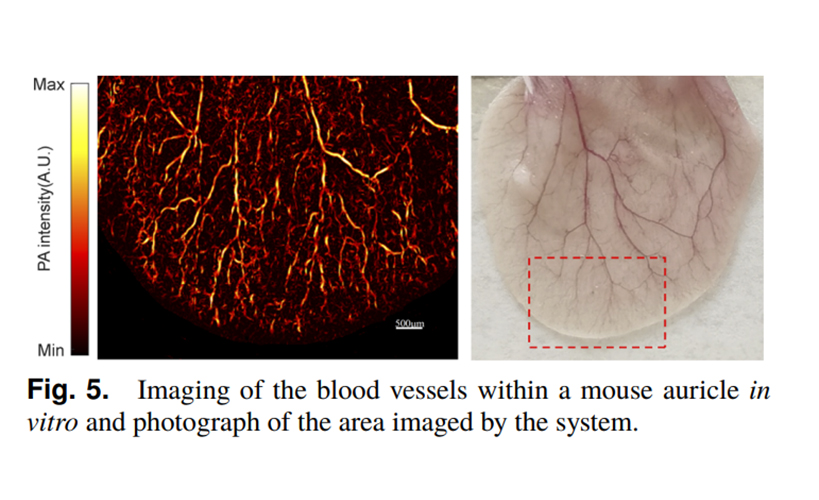 Application of Microchip Lasers in Photoacoustic Imaging