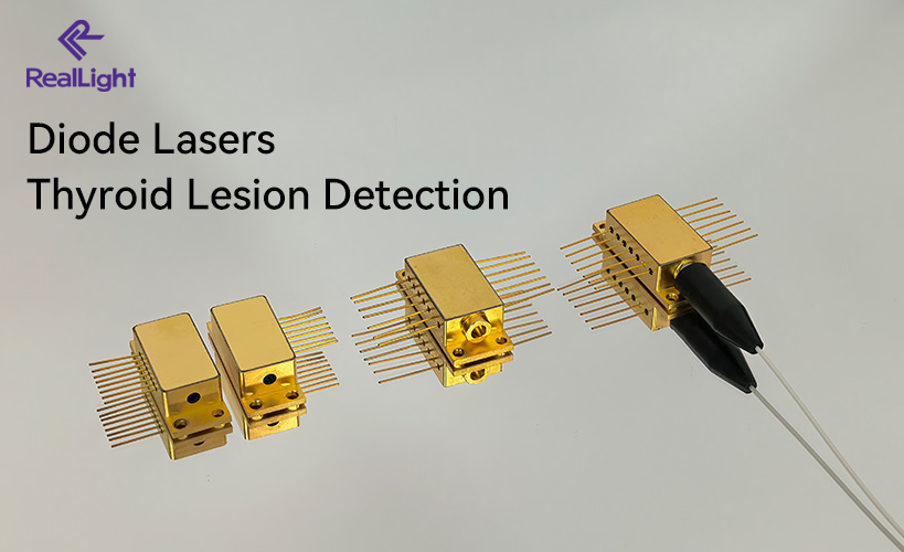 Diode laser: Empowering precise technology in thyroid lesion detection