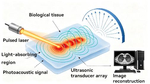 Schematic Diagram of Photoacoustic Imaging Principle